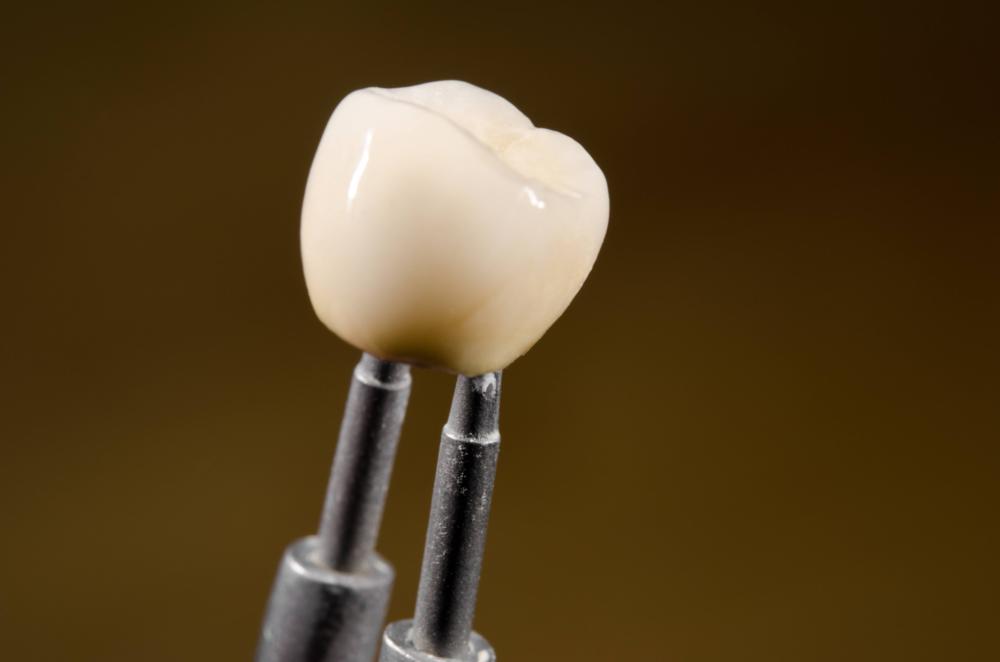 Composite Fillings | Fleischmann Family Dentistry | Broomfield, CO